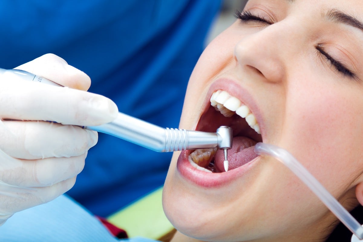 Dental Filling by Crystal Dental Clinic in Fergus
