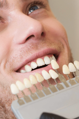 Dental Veneers by Crystal Dental Clinic in Fergus